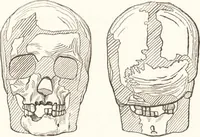An illustration from Ilios; the city and country of the Trojans. The results of researches and discoveries on the site of Troy and throughout the Troad in the years 1871-72-73-78-79, including an autobiography of the author (1880)