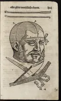 Picture 21 of 30 from Des aller fürtrefflichsten, höchsten vnnd adelichsten Gschöpffs aller Creaturen von Got dem Herren, Schöpffer aller Ding auff Erden, erschaffen : das ist, des Menschen (oder dein selbst) warhafftige Beschreibung, oder, Anatomi seines wunderbarlichen Vrsprungs ... (1541), leaf 146