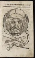 Picture 22 of 30 from Des aller fürtrefflichsten, höchsten vnnd adelichsten Gschöpffs aller Creaturen von Got dem Herren, Schöpffer aller Ding auff Erden, erschaffen : das ist, des Menschen (oder dein selbst) warhafftige Beschreibung, oder, Anatomi seines wunderbarlichen Vrsprungs ... (1541), leaf 148