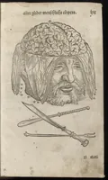 Picture 24 of 30 from Des aller fürtrefflichsten, höchsten vnnd adelichsten Gschöpffs aller Creaturen von Got dem Herren, Schöpffer aller Ding auff Erden, erschaffen : das ist, des Menschen (oder dein selbst) warhafftige Beschreibung, oder, Anatomi seines wunderbarlichen Vrsprungs ... (1541), leaf 152