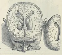 An illustration from Andreae Vesalii Bruxellensis, scholae medicorum Patauinae professoris De humani corporis fabrica libri septem (1543)