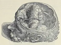 An illustration from Andreae Vesalii Bruxellensis, scholae medicorum Patauinae professoris De humani corporis fabrica libri septem (1543)