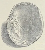 Picture 4 of 17 from Andreae Vesalii Bruxellensis, scholae medicorum Patauinae professoris De humani corporis fabrica libri septem (1543), leaf 70