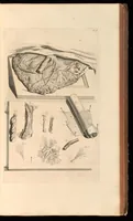 An illustration from Godefridi Bidloo, medicinae doctoris & chirurgi, Anatomia humani corporis : centum & quinque tabulis, per artificiosiss. G. de Lairesse ad vivum delineatis, demonstrata, veterum recentiorumque inventis explicata plurimisque hactenus non detectis, illustrata (1685)