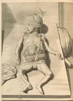 Picture 20 of 32 from Godefridi Bidloo, medicinae doctoris & chirurgi, Anatomia humani corporis : centum & quinque tabulis, per artificiosiss. G. de Lairesse ad vivum delineatis, demonstrata, veterum recentiorumque inventis explicata plurimisque hactenus non detectis, illustrata (1685), leaf 213