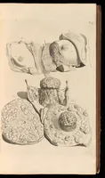 Picture 8 of 32 from Godefridi Bidloo, medicinae doctoris & chirurgi, Anatomia humani corporis : centum & quinque tabulis, per artificiosiss. G. de Lairesse ad vivum delineatis, demonstrata, veterum recentiorumque inventis explicata plurimisque hactenus non detectis, illustrata (1685), leaf 80