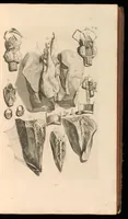 An illustration from Godefridi Bidloo, medicinae doctoris & chirurgi, Anatomia humani corporis : centum & quinque tabulis, per artificiosiss. G. de Lairesse ad vivum delineatis, demonstrata, veterum recentiorumque inventis explicata plurimisque hactenus non detectis, illustrata (1685)