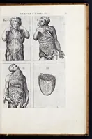An illustration from Vivae imagines partivm corporis hvmani aereis formis expressae (1566)