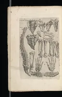 An illustration from Tables anatomiqves, avec les povrtraicts et declaration d'iceulx : ensemble vn denombrement de cinq cens maladies diuerses ... (1586)