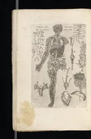An illustration from Tables anatomiqves, avec les povrtraicts et declaration d'iceulx : ensemble vn denombrement de cinq cens maladies diuerses ... (1586)