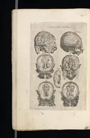 Picture 12 of 23 from Tables anatomiqves, avec les povrtraicts et declaration d'iceulx : ensemble vn denombrement de cinq cens maladies diuerses ... (1586), leaf 75