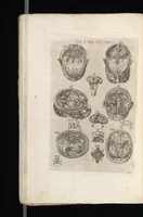 Picture 13 of 23 from Tables anatomiqves, avec les povrtraicts et declaration d'iceulx : ensemble vn denombrement de cinq cens maladies diuerses ... (1586), leaf 79