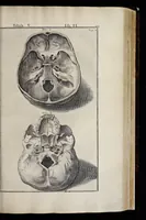 Picture 4 of 43 from Adriani Spigelii Bruxellensis equitis D. Marci, olim in Patavino gymnasio anatomiae et chirurgiae professoris primarii Opera quae extant, omnia (1645), leaf 364