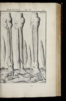 An illustration from Adriani Spigelii Bruxellensis equitis D. Marci, olim in Patavino gymnasio anatomiae et chirurgiae professoris primarii Opera quae extant, omnia (1645)