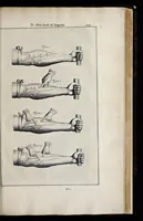 Picture 40 of 43 from Adriani Spigelii Bruxellensis equitis D. Marci, olim in Patavino gymnasio anatomiae et chirurgiae professoris primarii Opera quae extant, omnia (1645), leaf 668