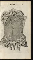 An illustration from Thomae Bartholini Anatome ex omnium veterum recentiorumque observationibus inprimis institutionibus b.m. parentis Caspari Bartholini : ad circulationem Harvejanam, et vasa lymphatica (1686)