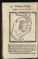 An illustration from De quatuor signis quae apparent in vnguibus manuum (1649)