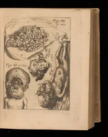 An illustration from Miscellanea curiosa, sive, Ephemeridum medico-physicarum Germanicarum (1677)