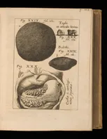 An illustration from Miscellanea curiosa, sive, Ephemeridum medico-physicarum Germanicarum (1677)