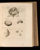 An illustration from Miscellanea curiosa, sive, Ephemeridum medico-physicarum Germanicarum (1677)