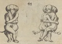 An illustration from Monstrorum historia memorabilis : monstrosa humanorum partuum miracula : stupendis conformationum formulis ab vtero materno enata : viuis exemplis, obseruationibus, & picturis, referens : accessit analogicum argumentum de monstris brutis : Supplementi loco ad observationes medicas Schenkianas edita (1609)