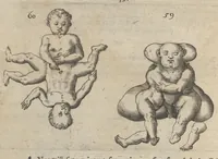 An illustration from Monstrorum historia memorabilis : monstrosa humanorum partuum miracula : stupendis conformationum formulis ab vtero materno enata : viuis exemplis, obseruationibus, & picturis, referens : accessit analogicum argumentum de monstris brutis : Supplementi loco ad observationes medicas Schenkianas edita (1609)