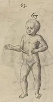 An illustration from Monstrorum historia memorabilis : monstrosa humanorum partuum miracula : stupendis conformationum formulis ab vtero materno enata : viuis exemplis, obseruationibus, & picturis, referens : accessit analogicum argumentum de monstris brutis : Supplementi loco ad observationes medicas Schenkianas edita (1609)