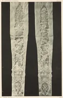 An illustration from Les dentelles à la main: dentelles aux fuseaux--dentelles à l'aiguille--dentelles à points mélangés; 135 planches, accompagnées de légendes et précédées de descriptions détaillées des différents points (1906)