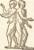 An illustration from De naturae diuinis characterismis, seu, Raris & admirandis spectaculis, causis, indiciis, proprietatibus rerum in partibus singulis vniuersi, libri II (1575)