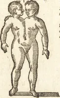 An illustration from De naturae diuinis characterismis, seu, Raris & admirandis spectaculis, causis, indiciis, proprietatibus rerum in partibus singulis vniuersi, libri II (1575)