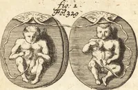 An illustration from C. Stalpartii vander Wiel medici Hagiensis Observationum rariorum medic. anatomic. chirurgicarum centuria prior : accedit De unicornu dissertatio : utraque tertia parte auctior, longeque emendatior (1687)