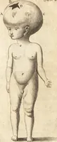 An illustration from C. Stalpartii vander Wiel medici Hagiensis Observationum rariorum medic. anatomic. chirurgicarum centuria prior : accedit De unicornu dissertatio : utraque tertia parte auctior, longeque emendatior (1687)
