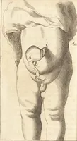 An illustration from C. Stalpartii vander Wiel medici Hagiensis Observationum rariorum medic. anatomic. chirurgicarum centuria prior : accedit De unicornu dissertatio : utraque tertia parte auctior, longeque emendatior (1687)