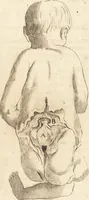 An illustration from C. Stalpartii vander Wiel medici Hagiensis Observationum rariorum medic. anatomic. chirurgicarum centuria prior : accedit De unicornu dissertatio : utraque tertia parte auctior, longeque emendatior (1687)