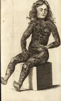 An illustration from C. Stalpartii vander Wiel medici Hagiensis Observationum rariorum medic. anatomic. chirurgicarum centuria prior : accedit De unicornu dissertatio : utraque tertia parte auctior, longeque emendatior (1687)