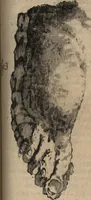 An illustration from C. Stalpartii vander Wiel medici Hagiensis Observationum rariorum medic. anatomic. chirurgicarum centuria prior : accedit De unicornu dissertatio : utraque tertia parte auctior, longeque emendatior (1687)