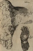 An illustration from C. Stalpartii vander Wiel medici Hagiensis Observationum rariorum medic. anatomic. chirurgicarum centuria prior : accedit De unicornu dissertatio : utraque tertia parte auctior, longeque emendatior (1687)