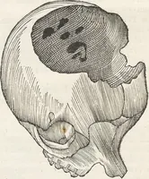 An illustration from Museum Wormianum, seu, Historia rerum rariorum : tam naturalium, quam artificialium, tam domesticarum, quam exoticarum, quae Hafniae Danorum in aedibus authoris servantur (1655)
