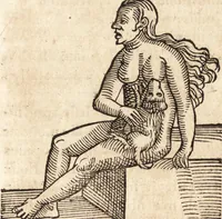 An illustration from Prodigiorvm ac ostentorvm chronicon : quae praeter naturae ordinem, motum, et operationem, et in svperioribus & his inferioribus mundi regionibus, ab exordio mundi usque ad haec nostra tempora, acciderunt ... (1557)