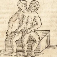 An illustration from Prodigiorvm ac ostentorvm chronicon : quae praeter naturae ordinem, motum, et operationem, et in svperioribus & his inferioribus mundi regionibus, ab exordio mundi usque ad haec nostra tempora, acciderunt ... (1557)