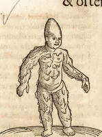 An illustration from Prodigiorvm ac ostentorvm chronicon : quae praeter naturae ordinem, motum, et operationem, et in svperioribus & his inferioribus mundi regionibus, ab exordio mundi usque ad haec nostra tempora, acciderunt ... (1557)