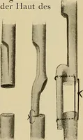 An illustration from Grundriss und Atlas der allgemeinen Chirurgie (1905)