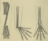 An illustration from Grundriss und Atlas der allgemeinen Chirurgie (1905)