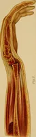 Picture 36 of 116 from Grundriss und Atlas der allgemeinen Chirurgie (1905), leaf 119