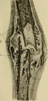 An illustration from Grundriss und Atlas der allgemeinen Chirurgie (1905)