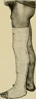 Picture 40 of 116 from Grundriss und Atlas der allgemeinen Chirurgie (1905), leaf 129