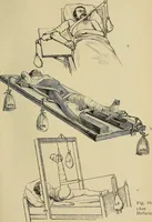 An illustration from Grundriss und Atlas der allgemeinen Chirurgie (1905)