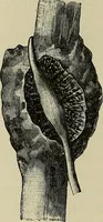 Picture 43 of 110 from Grundriss und Atlas der allgemeinen Chirurgie (1905), leaf 136