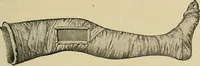 An illustration from Grundriss und Atlas der allgemeinen Chirurgie (1905)