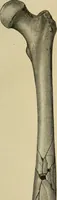 Picture 49 of 110 from Grundriss und Atlas der allgemeinen Chirurgie (1905), leaf 179